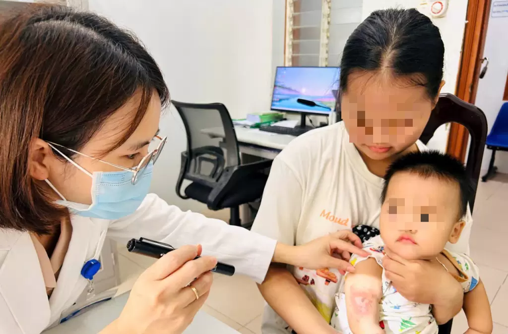 顺化隐翅虫皮炎病例增加,警示自行诊断治疗