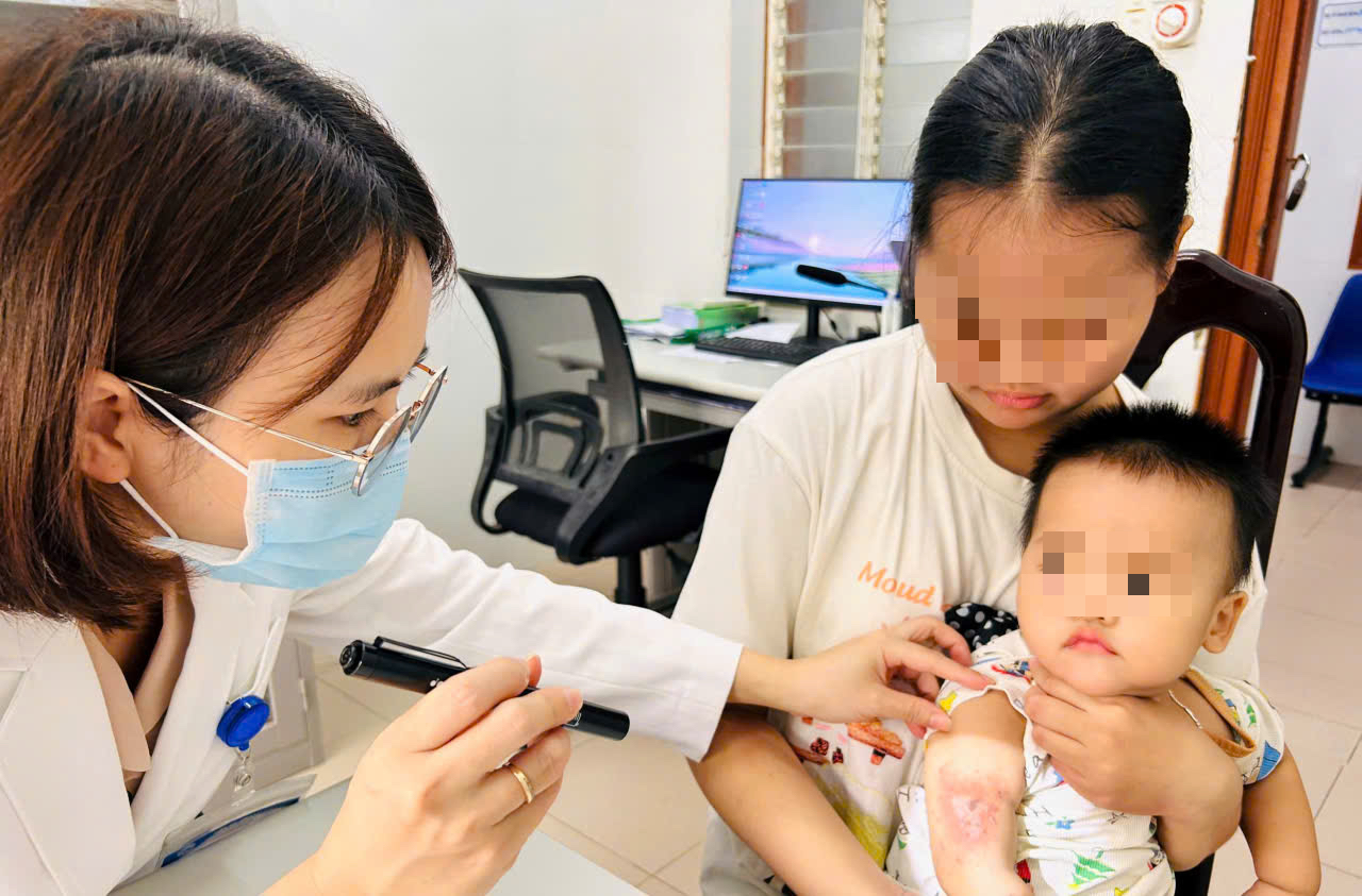 顺化隐翅虫皮炎病例增加,警示自行诊断治疗