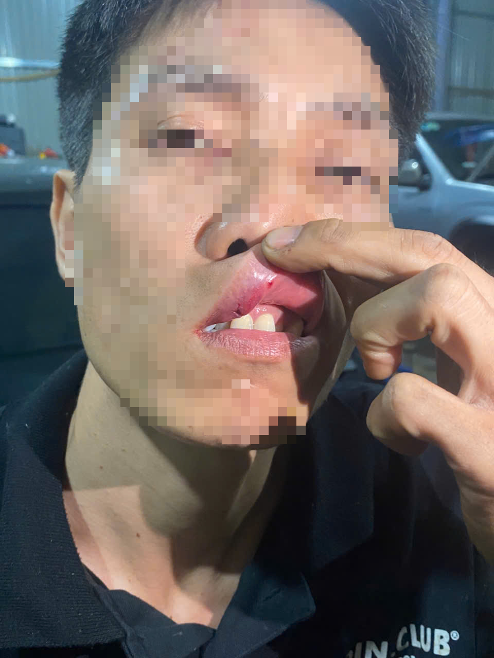 警方承诺严惩闯入他人住宅施暴的男子案件