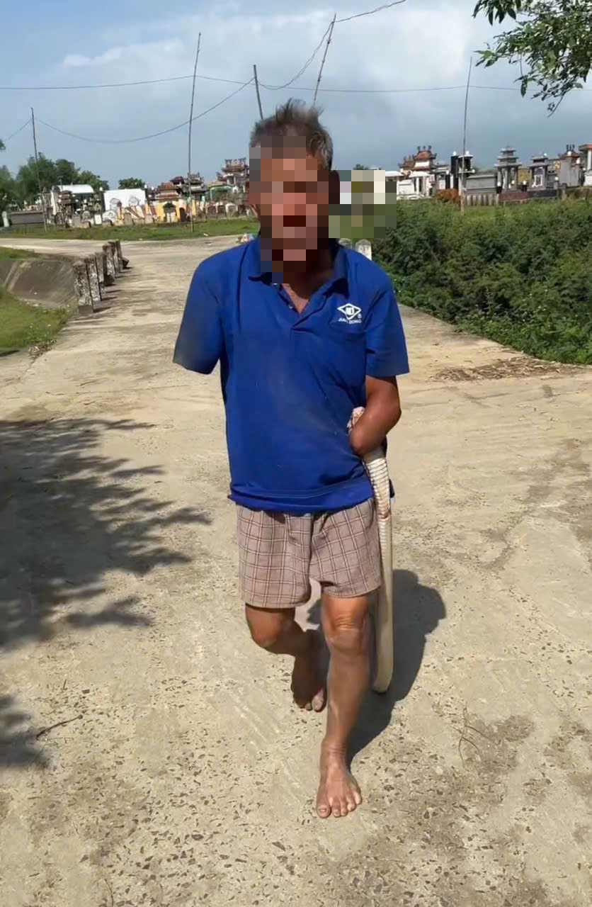 失去雙手的老人被眼鏡蛇咬傷後仍夾著蛇回家