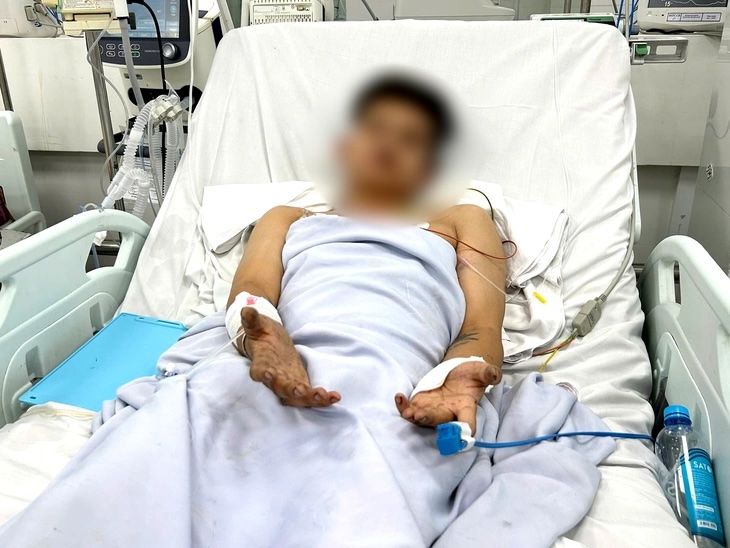 胡志明市出租屋火災中成功救出5名煙霧窒息者